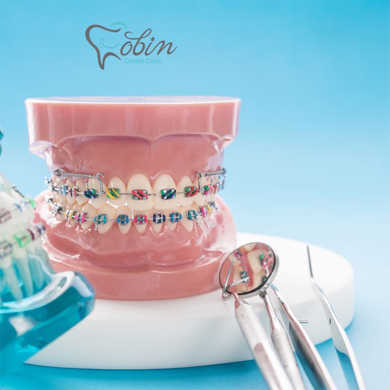 تفاوت کلیدی بین ارتودنتیست ها و دندانپزشکان 